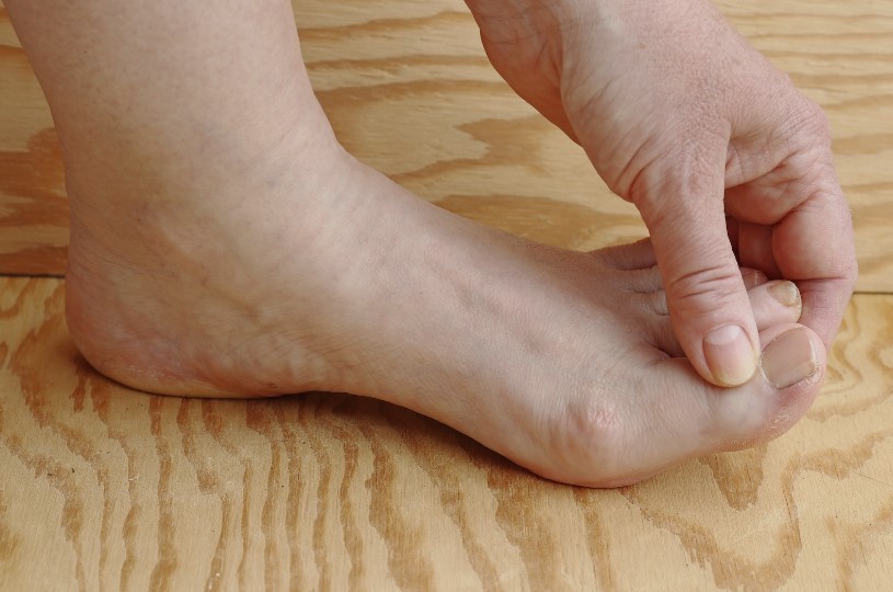 Gljivice na stopalima gljivična su infekcija